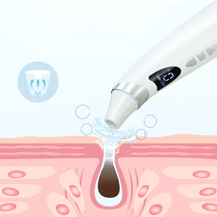 Electric Visual Blackhead Suction Instrument Household Cleansing Pore Cleaner For Skin Equipment Skin Care Tool - [[{"value":"{{ Babyvera Babyvera  }}"}]]