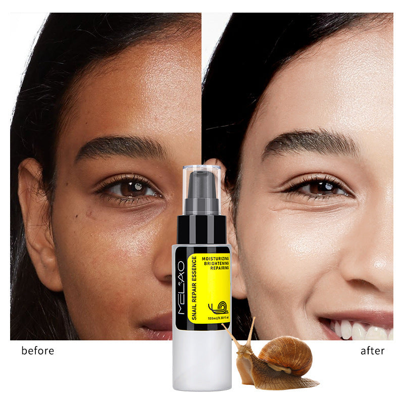 Snail Skin Care Facial Care Solution - [[{"value":"{{ Babyvera Babyvera  }}"}]]