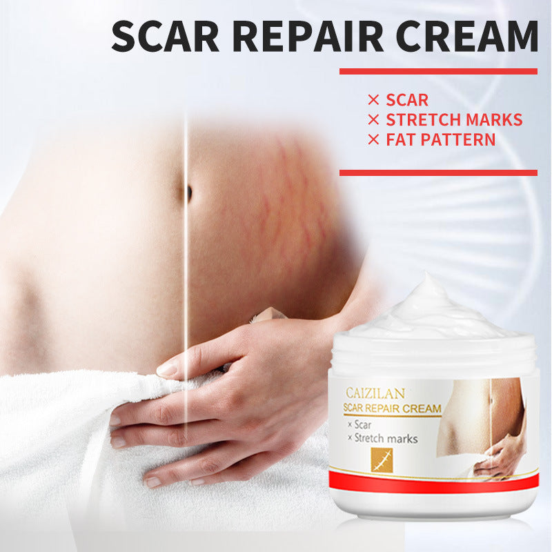 Pregnant Women Acne Scar Repair Cream Skin Care 30g - [[{"value":"{{ Babyvera Babyvera  }}"}]]