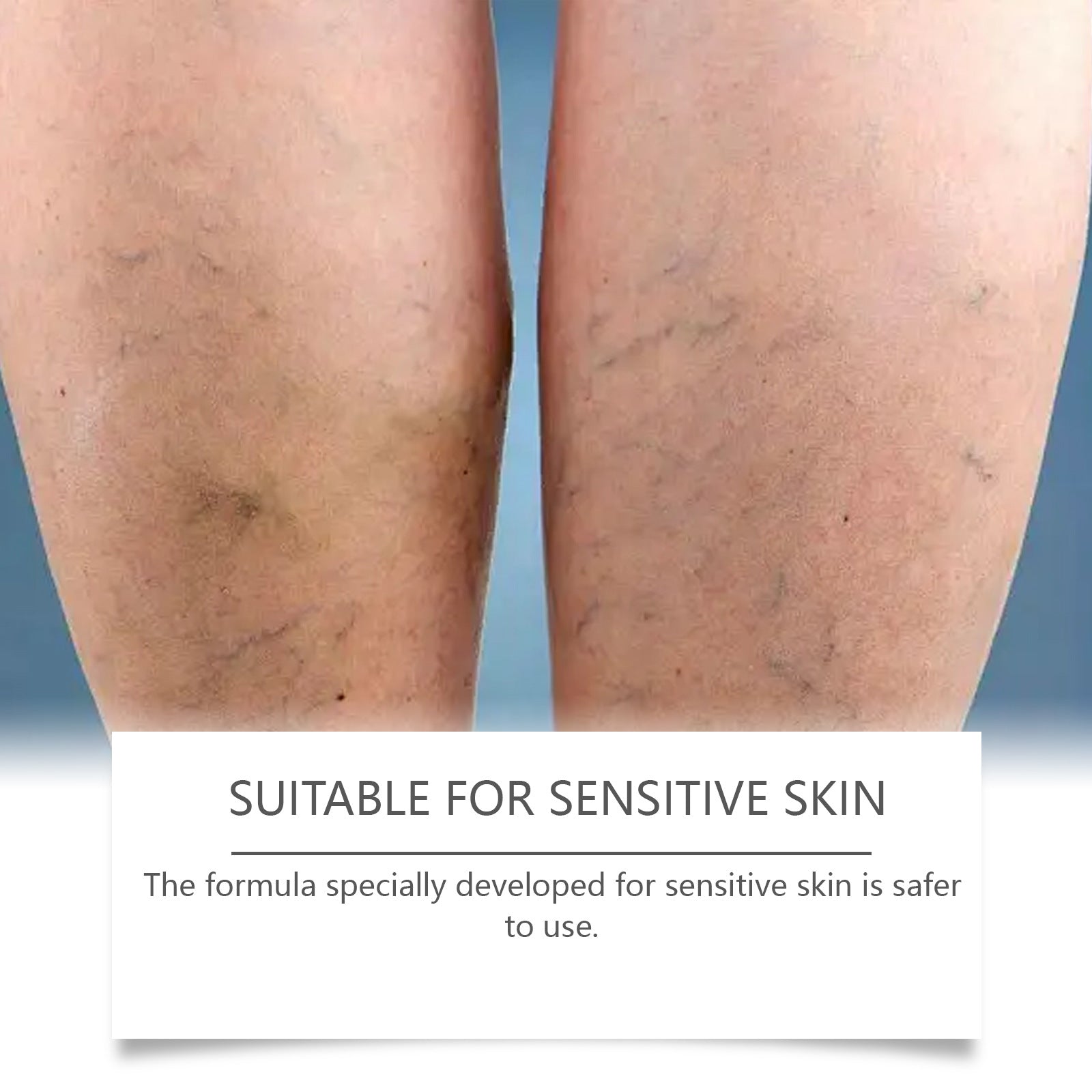 Gentle Care And Massage Of The Legs To Relieve Discomfort, Nourish And Comfort - [[{"value":"{{ Babyvera Babyvera  }}"}]]